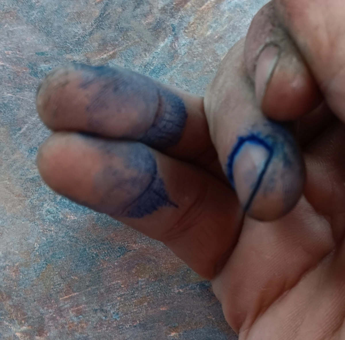 Fingers stained with resin dye.